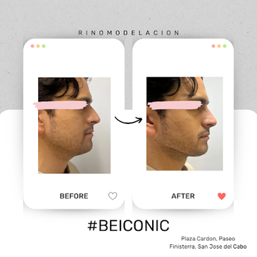 Slider image (4) ICONIC Medical Aesthetic